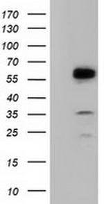 TCP11L2 Antibody in Western Blot (WB)