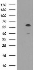 TCP11L2 Antibody in Western Blot (WB)