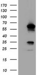 TCP11L2 Antibody in Western Blot (WB)