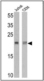 TCR V delta 2 Antibody in Western Blot (WB)