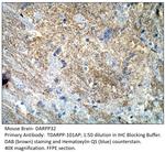 DARPP32 Antibody in Immunohistochemistry (IHC)