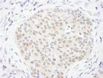 TDG Antibody in Immunohistochemistry (IHC)