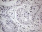 TDG Antibody in Immunohistochemistry (Paraffin) (IHC (P))