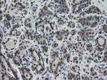 TDO2 Antibody in Immunohistochemistry (Paraffin) (IHC (P))