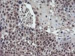 TDO2 Antibody in Immunohistochemistry (Paraffin) (IHC (P))