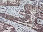 TDO2 Antibody in Immunohistochemistry (Paraffin) (IHC (P))