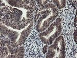 TDO2 Antibody in Immunohistochemistry (Paraffin) (IHC (P))