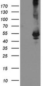 TDO2 Antibody in Western Blot (WB)