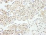 TDP1 Antibody in Immunohistochemistry (IHC)