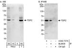 TDP2 Antibody in Western Blot (WB)