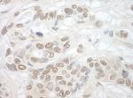 TDRD3 Antibody in Immunohistochemistry (IHC)