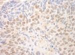 TDRD3 Antibody in Immunohistochemistry (IHC)