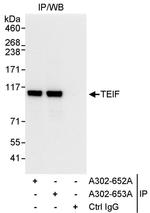 TEIF Antibody in Immunoprecipitation (IP)