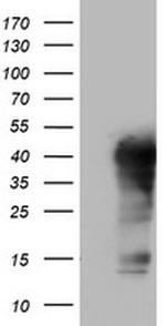 TET1 Antibody in Western Blot (WB)