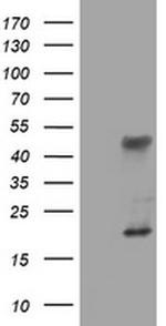 TET1 Antibody in Western Blot (WB)