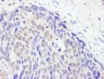 TET2 Antibody in Immunohistochemistry (IHC)