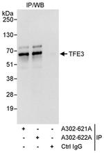 TFE3 Antibody in Immunoprecipitation (IP)