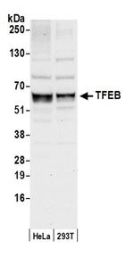 TFEB Antibody in Western Blot (WB)