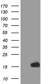 TFF3 Antibody in Western Blot (WB)