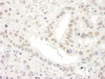 TFIIS Antibody in Immunohistochemistry (IHC)