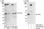 TFIIS Antibody in Western Blot (WB)