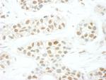 TFIIS Antibody in Immunohistochemistry (IHC)