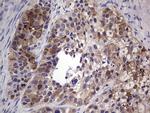 TFPI2 Antibody in Immunohistochemistry (Paraffin) (IHC (P))