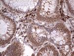 TFPI2 Antibody in Immunohistochemistry (Paraffin) (IHC (P))