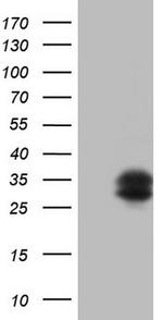 TFPI2 Antibody in Western Blot (WB)