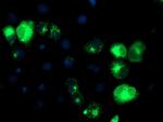 TFR2 Antibody in Immunocytochemistry (ICC/IF)