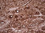 TG Antibody in Immunohistochemistry (Paraffin) (IHC (P))