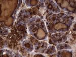 TG Antibody in Immunohistochemistry (Paraffin) (IHC (P))