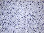 TG Antibody in Immunohistochemistry (Paraffin) (IHC (P))