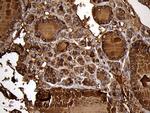 TG Antibody in Immunohistochemistry (Paraffin) (IHC (P))