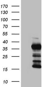 TG Antibody in Western Blot (WB)