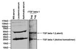 TGF beta-1 Antibody in Western Blot (WB)