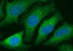 TGFB1 Antibody in Immunocytochemistry (ICC/IF)