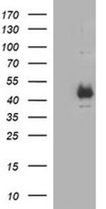 TGFB1 Antibody in Western Blot (WB)