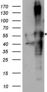 TGFB1I1 Antibody in Western Blot (WB)