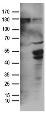 TGFB2 Antibody in Western Blot (WB)