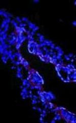 TGF beta-3 Antibody in Immunocytochemistry (ICC/IF)