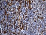 TGFBI Antibody in Immunohistochemistry (Paraffin) (IHC (P))