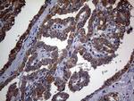 TGFBR2 Antibody in Immunohistochemistry (Paraffin) (IHC (P))