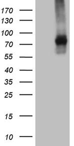 TGFBR2 Antibody in Western Blot (WB)