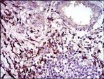 LAP (Latency Associated Peptide) Antibody in Immunohistochemistry (Paraffin) (IHC (P))