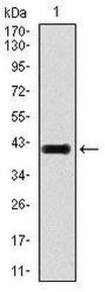 LAP (Latency Associated Peptide) Antibody in Western Blot (WB)