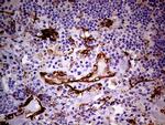 TGM2 Antibody in Immunohistochemistry (Paraffin) (IHC (P))