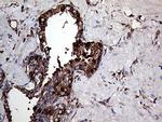 TGM2 Antibody in Immunohistochemistry (Paraffin) (IHC (P))