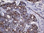 TGM2 Antibody in Immunohistochemistry (Paraffin) (IHC (P))