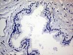 TGM2 Antibody in Immunohistochemistry (Paraffin) (IHC (P))